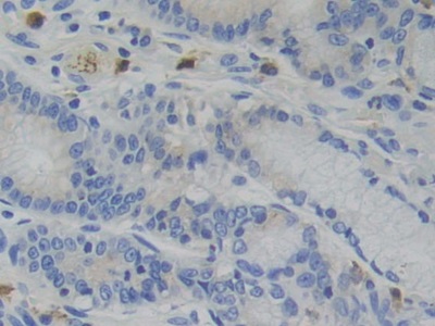 Immunohistochemistry (Formalin/PFA-fixed paraffin-embedded sections) - Anti-Glucocorticoid Receptor beta antibody (AB233165), expandable thumbnail