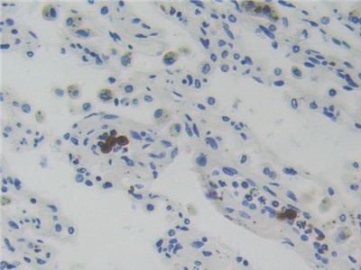 Immunohistochemistry (Formalin/PFA-fixed paraffin-embedded sections) - Anti-Glucocorticoid Receptor beta antibody (AB233165), expandable thumbnail