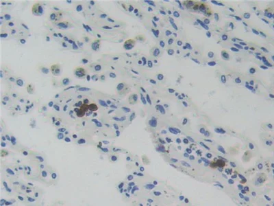 Immunohistochemistry (Formalin/PFA-fixed paraffin-embedded sections) - Anti-Glucocorticoid Receptor beta antibody (AB233165)