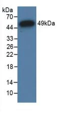 Western blot - Anti-Glucocorticoid Receptor beta antibody (AB233165)