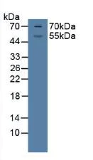 Western blot - Anti-Glucocorticoid Receptor beta antibody (AB233165)