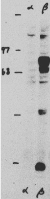 Western blot - Anti-Glucocorticoid Receptor beta antibody (AB3581), expandable thumbnail