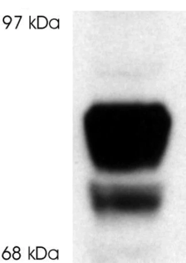 Western blot - Anti-Glucocorticoid Receptor beta antibody (AB3581)