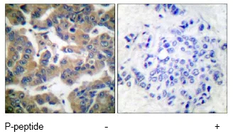 Immunohistochemistry (Formalin/PFA-fixed paraffin-embedded sections) - Anti-Glucocorticoid Receptor (phospho S211) antibody (AB55189)
