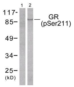 Western blot - Anti-Glucocorticoid Receptor (phospho S211) antibody (AB55189), expandable thumbnail