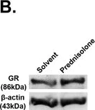 Western blot - Anti-Glucocorticoid Receptor (phospho S211) antibody (AB55189)