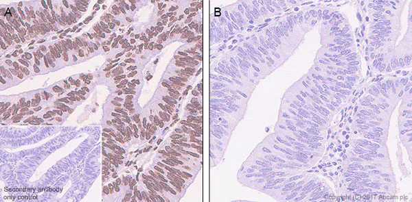 Immunohistochemistry (Formalin/PFA-fixed paraffin-embedded sections) - Anti-Glucocorticoid Receptor (phospho S226) antibody [EPR22216-414] (AB228972)
