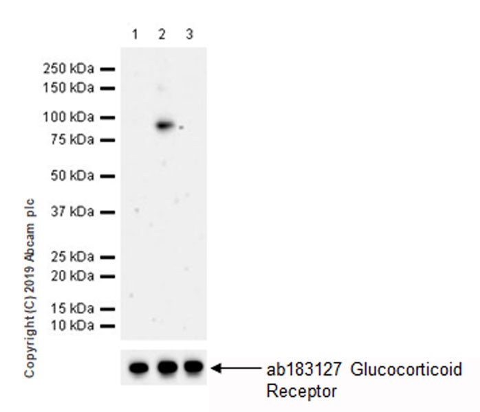 Western blot - Anti-Glucocorticoid Receptor (phospho S226) antibody [EPR22216-414] (AB228972), expandable thumbnail