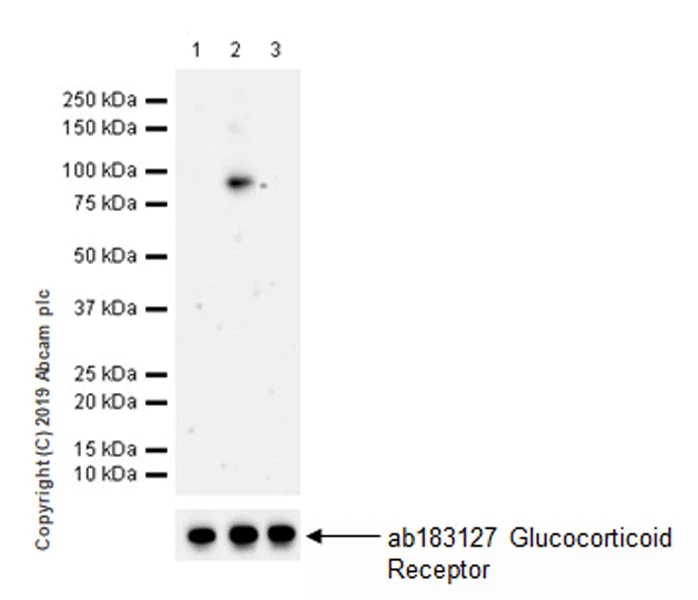 Western blot - Anti-Glucocorticoid Receptor (phospho S226) antibody [EPR22216-414] (AB228972)