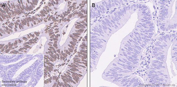 Immunohistochemistry (Formalin/PFA-fixed paraffin-embedded sections) - Anti-Glucocorticoid Receptor (phospho S226) antibody [EPR22216-414] - BSA and Azide free (AB256549), expandable thumbnail