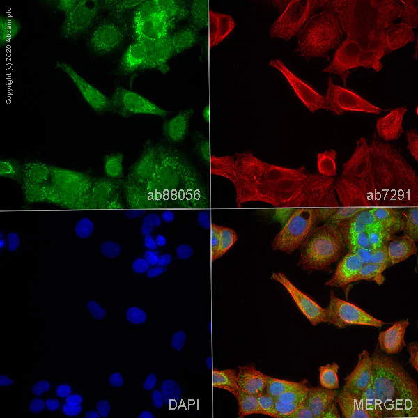 Immunocytochemistry/ Immunofluorescence - Anti-Glucokinase antibody (AB88056)