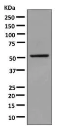 Western blot - Anti-Glucokinase antibody [EPR10374] - BSA and Azide free (AB249216)