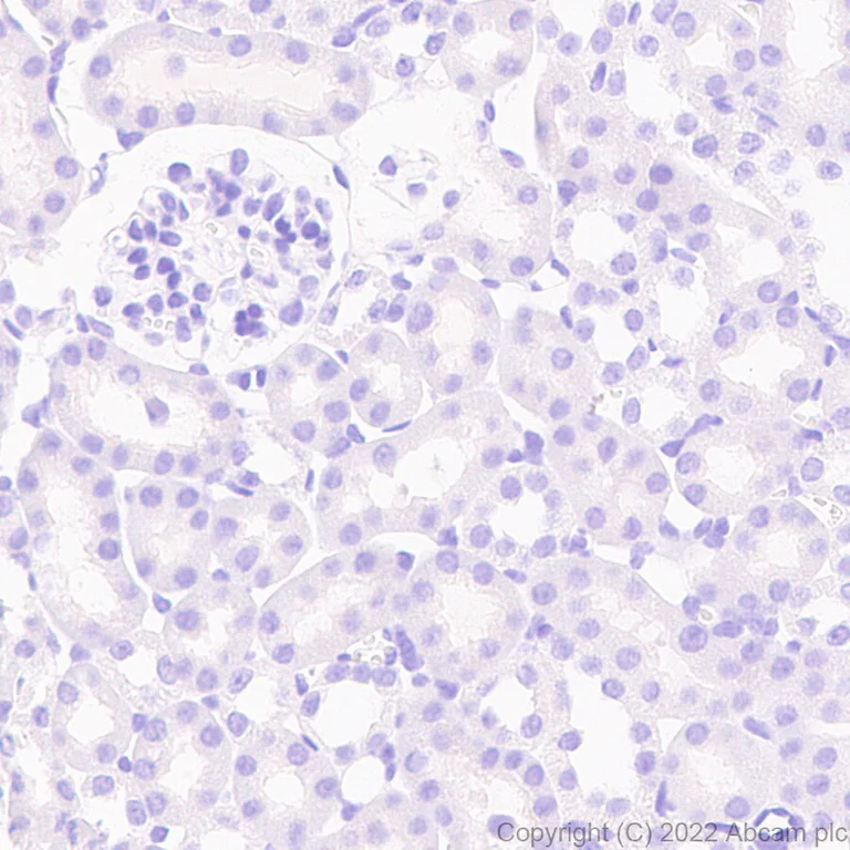 Immunohistochemistry (Formalin/PFA-fixed paraffin-embedded sections) - Anti-Glucokinase antibody [EPR25847-150] (AB303612)