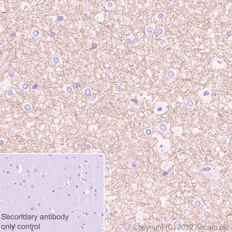 Immunohistochemistry (Formalin/PFA-fixed paraffin-embedded sections) - Anti-Glucokinase antibody [EPR25847-150] (AB303612)