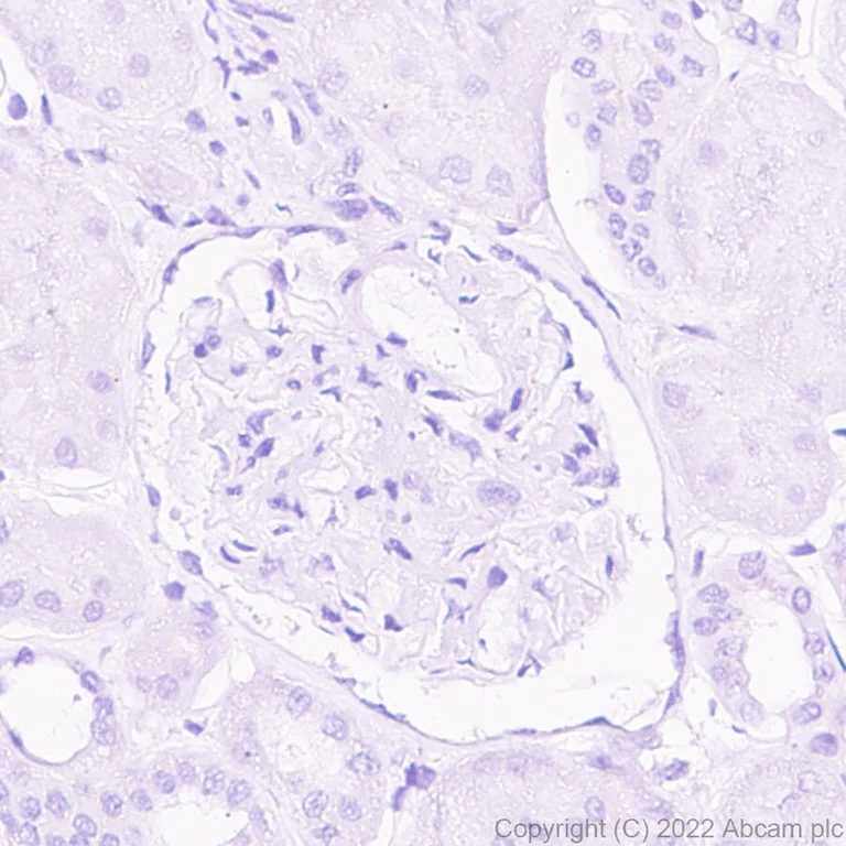 Immunohistochemistry (Formalin/PFA-fixed paraffin-embedded sections) - Anti-Glucokinase antibody [EPR25847-150] - BSA and Azide free (AB303613)