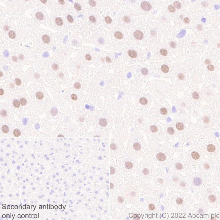 Immunohistochemistry (Formalin/PFA-fixed paraffin-embedded sections) - Anti-Glucokinase antibody [EPR25847-150] - BSA and Azide free (AB303613)