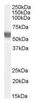 Western blot - Anti-Glucose 6 Phosphate Dehydrogenase antibody (AB106810)