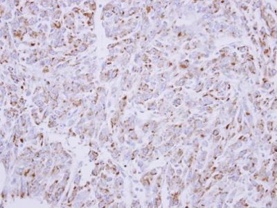 Immunohistochemistry (Formalin/PFA-fixed paraffin-embedded sections) - Anti-Glucose 6 Phosphate Dehydrogenase antibody (AB226964)