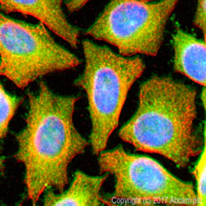 Immunocytochemistry/ Immunofluorescence - Anti-Glucose 6 Phosphate Dehydrogenase antibody (AB87230)