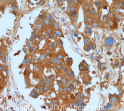 Immunohistochemistry (Formalin/PFA-fixed paraffin-embedded sections) - Anti-Glucose 6 Phosphate Dehydrogenase antibody (AB87230)
