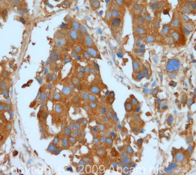 Immunohistochemistry (Formalin/PFA-fixed paraffin-embedded sections) - Anti-Glucose 6 Phosphate Dehydrogenase antibody (AB87230)