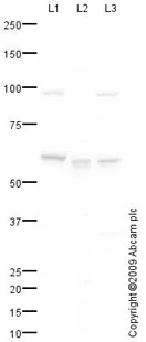 Western blot - Anti-Glucose 6 Phosphate Dehydrogenase antibody (AB87230)