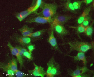 Immunocytochemistry/ Immunofluorescence - Anti-Glucose 6 Phosphate Dehydrogenase antibody (AB993)