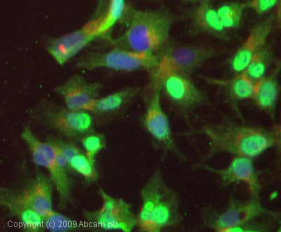Immunocytochemistry/ Immunofluorescence - Anti-Glucose 6 Phosphate Dehydrogenase antibody (AB993)