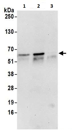 Anti-Glucose 6 Phosphate Dehydrogenase antibody