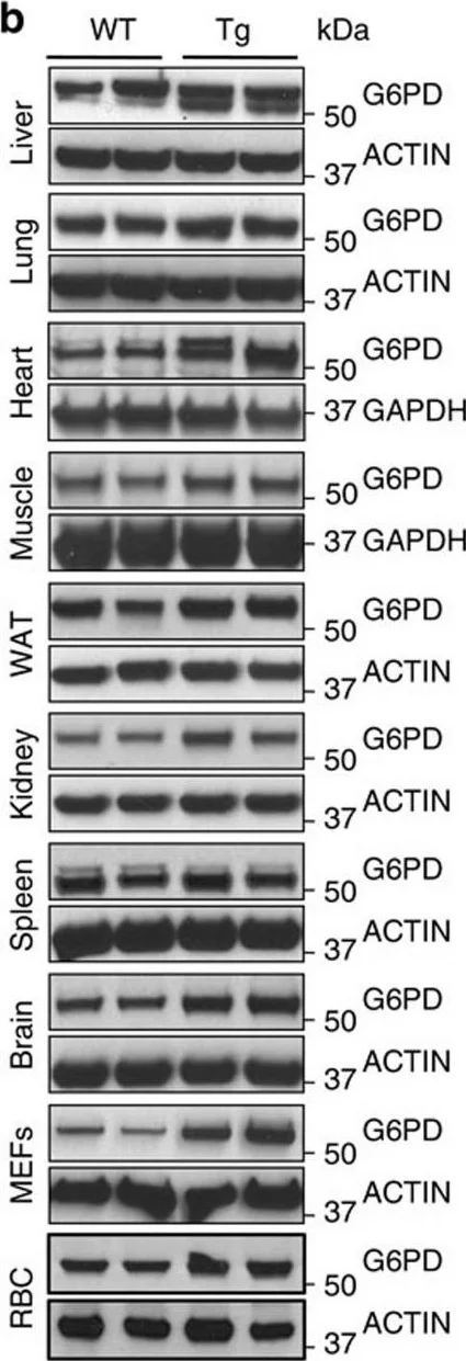 Western blot - Anti-Glucose 6 Phosphate Dehydrogenase antibody (AB993)