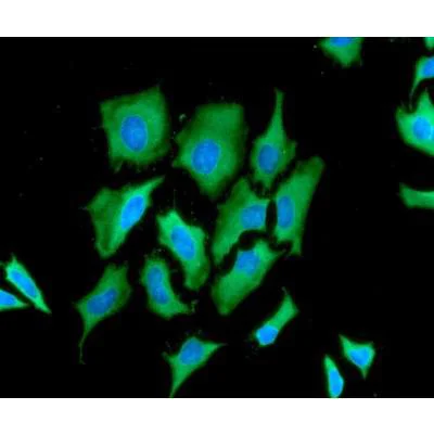 Immunocytochemistry/ Immunofluorescence - Anti-Glucose 6 Phosphate Dehydrogenase antibody [AT2F6] (AB91034)