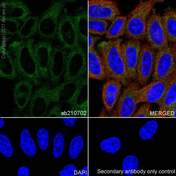 Immunocytochemistry/ Immunofluorescence - Anti-Glucose 6 Phosphate Dehydrogenase antibody [EPR20668] (AB210702), expandable thumbnail