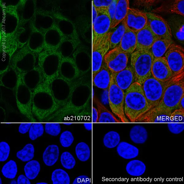 Immunocytochemistry/ Immunofluorescence - Anti-Glucose 6 Phosphate Dehydrogenase antibody [EPR20668] (AB210702)