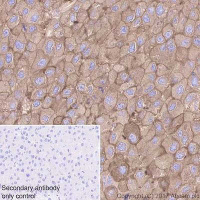 Immunohistochemistry (Formalin/PFA-fixed paraffin-embedded sections) - Anti-Glucose 6 Phosphate Dehydrogenase antibody [EPR20668] (AB210702)