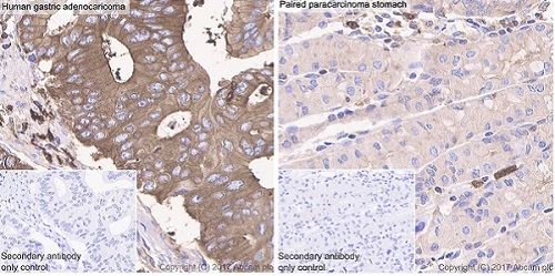 Immunohistochemistry (Formalin/PFA-fixed paraffin-embedded sections) - Anti-Glucose 6 Phosphate Dehydrogenase antibody [EPR20668] (ab210702), expandable thumbnail