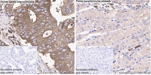 Immunohistochemistry (Formalin/PFA-fixed paraffin-embedded sections) - Anti-Glucose 6 Phosphate Dehydrogenase antibody [EPR20668] (AB210702)