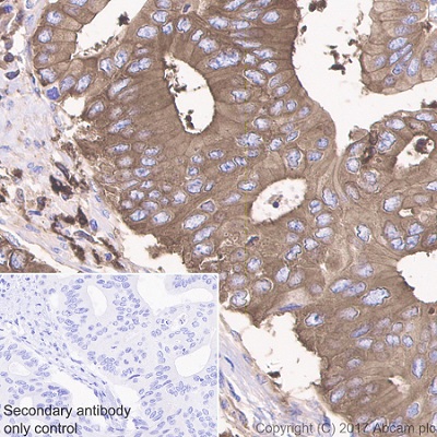 Immunohistochemistry (Formalin/PFA-fixed paraffin-embedded sections) - Anti-Glucose 6 Phosphate Dehydrogenase antibody [EPR20668] (ab210702), expandable thumbnail