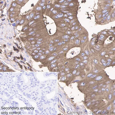 Immunohistochemistry (Formalin/PFA-fixed paraffin-embedded sections) - Anti-Glucose 6 Phosphate Dehydrogenase antibody [EPR20668] (AB210702)