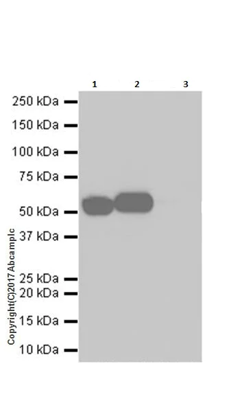 Immunoprecipitation - Anti-Glucose 6 Phosphate Dehydrogenase antibody [EPR20668] (AB210702)