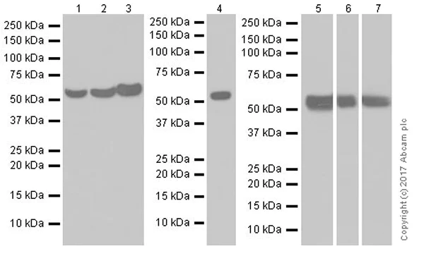 Western blot - Anti-Glucose 6 Phosphate Dehydrogenase antibody [EPR20668] (AB210702)