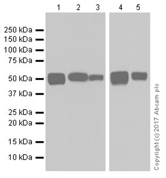 Western blot - Anti-Glucose 6 Phosphate Dehydrogenase antibody [EPR20668] (AB210702), expandable thumbnail