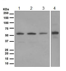 Western blot - Anti-Glucose 6 Phosphate Dehydrogenase antibody [EPR6291] - BSA and Azide free (AB247989), expandable thumbnail