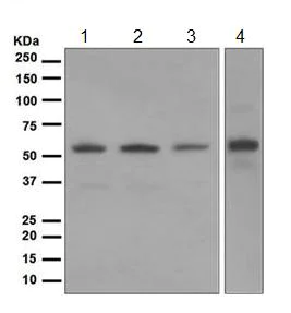 Western blot - Anti-Glucose 6 Phosphate Dehydrogenase antibody [EPR6291] - BSA and Azide free (AB247989)