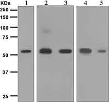 Western blot - Anti-Glucose 6 Phosphate Dehydrogenase antibody [EPR6292] (AB133525)