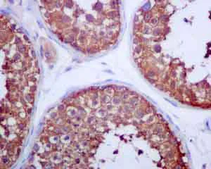 Immunohistochemistry (Formalin/PFA-fixed paraffin-embedded sections) - Anti-Glucose 6 Phosphate Dehydrogenase antibody [EPR6292] - BSA and Azide free (AB218120)