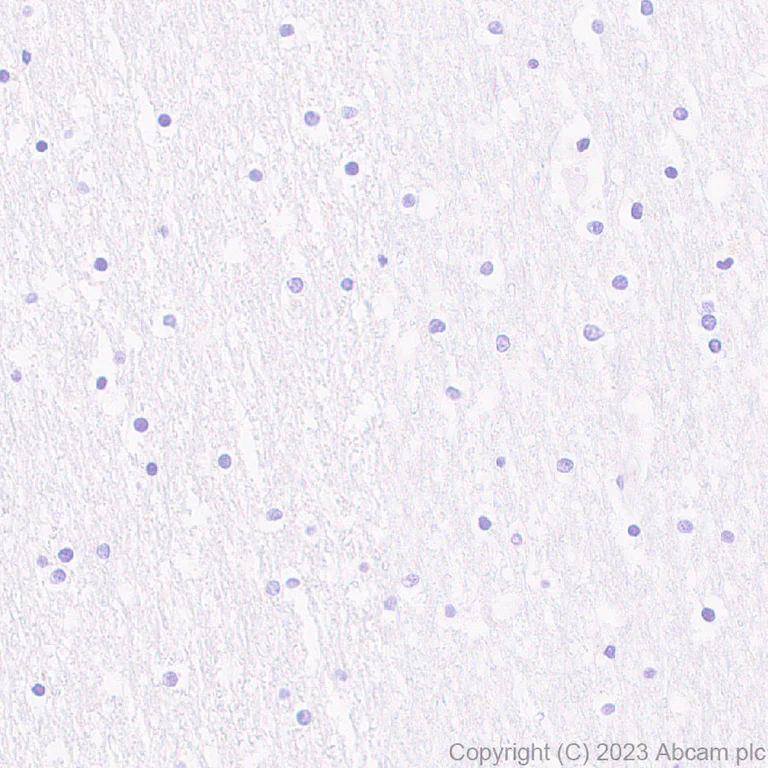 Immunohistochemistry (Formalin/PFA-fixed paraffin-embedded sections) - Anti-Glucose Oxidase antibody [EPR27335-25] (AB314545)