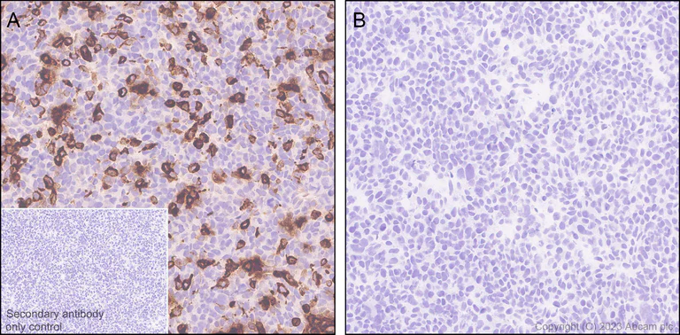 Immunohistochemistry (Formalin/PFA-fixed paraffin-embedded sections) - Anti-Glucose Oxidase antibody [EPR27335-25] - BSA and Azide free (AB314546)