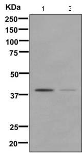 Western blot - Anti-Glucose Transporter 8 antibody [EPR9477] (AB169779)
