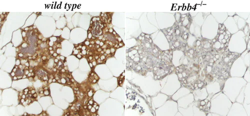 Immunohistochemistry (Formalin/PFA-fixed paraffin-embedded sections) - Anti-Glucose Transporter GLUT1 antibody (AB14683)