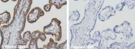 Immunohistochemistry (Formalin/PFA-fixed paraffin-embedded sections) - Anti-Glucose Transporter GLUT1 antibody (AB14683)